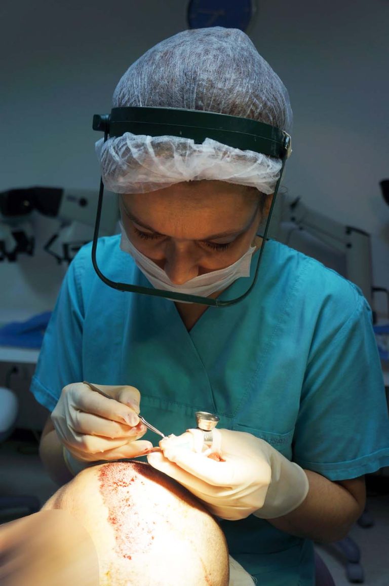 hair transplant assistant is placing grafts into the recipient sites in Hairmed clinic in Istanbul