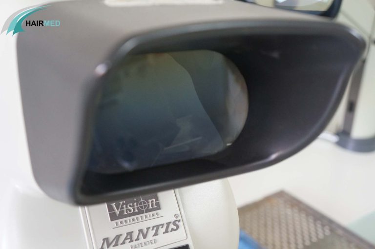 Microscopes Mantis pour greffe de cheveux FUT & FUE