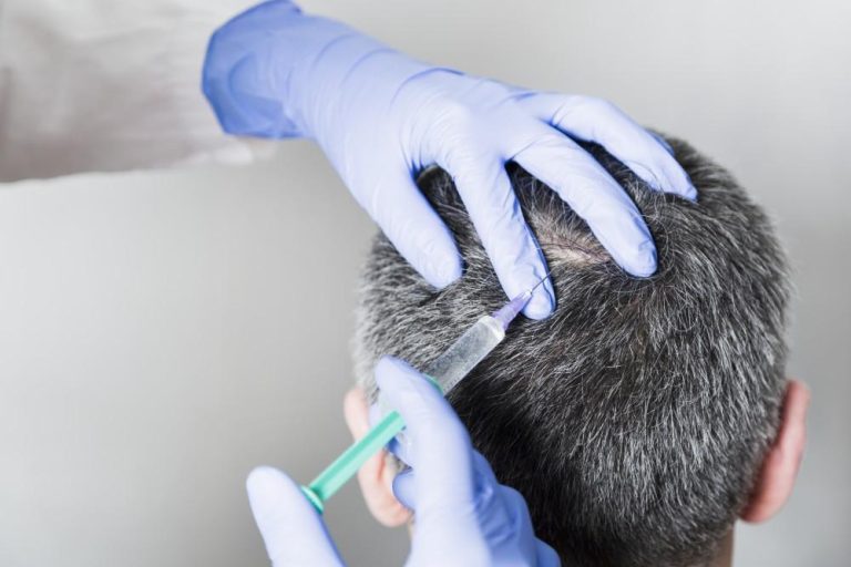كيف تساعد حقن البلازما الغنية بالصفائح الدموية في نمو الشعر؟