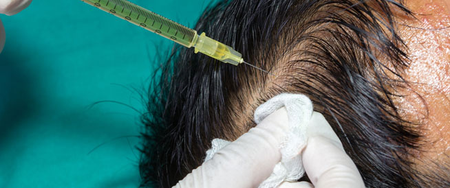 الهبوط الكبير لليورو يزيد الإقبال على عمليات زراعة الشعر في تركيا وأوربا
