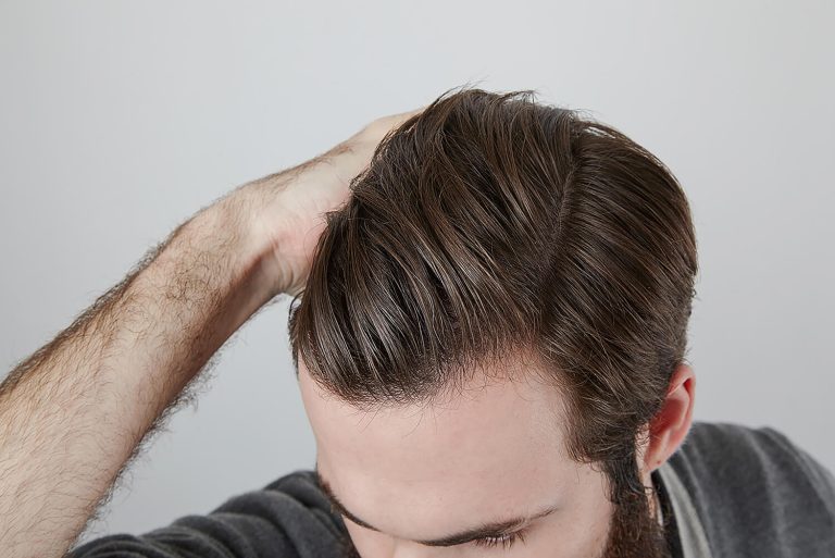 الخطر الخفي: تأثير منتجات العناية بالشعر ذات الجودة الرديئة على فروة الرأس وسلامة الشعر
