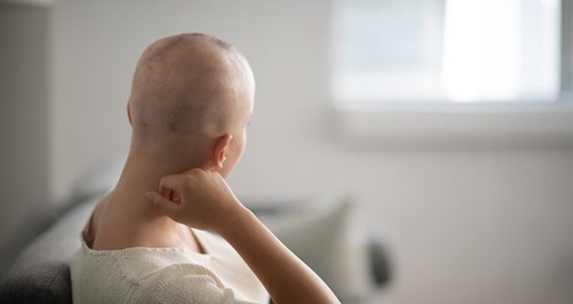 العلاج الكيميائي و تساقط الشعر